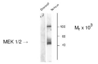 Western Blot: MEK1 [p Ser218, p Ser222] Antibody [NB500-139]